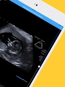 RadLink Mobile imagem de tela 6