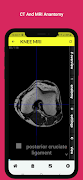 Radiology Anatomy CT And MRI स्क्रीनशॉट 2