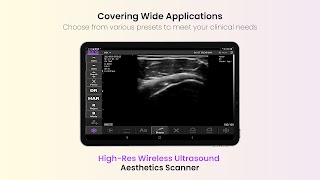 SONOFINDER স্ক্রিনশট 6