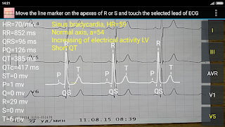 ECG Reader 2 free screenshot 1