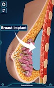 Breast Anatomy Pro. 스크린샷 5