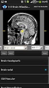 3-D brain Atlas screenshot 1