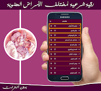 1 Schermata رقية الأمراض العضوية بدون نت