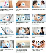 Breast Cancer Guide poster