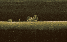 HummSucker screenshot 7