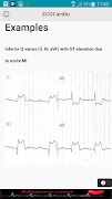 برنامه‌نما ECGCardio عکس از صفحه