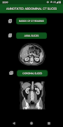 abdominal CT: annotated slices screenshot 4