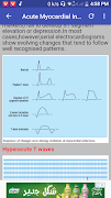 Clinical ECG Guide. screenshot 6