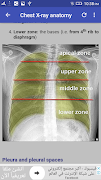 Chest X-Ray Interpretation ภาพหน้าจอ 5
