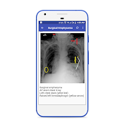 X-Ray Interpretation Guide screenshot 4