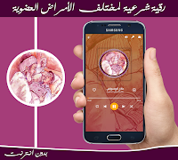 رقية الأمراض العضوية بدون نت 截圖 2