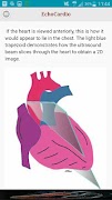 EchoCardio 스크린샷 3