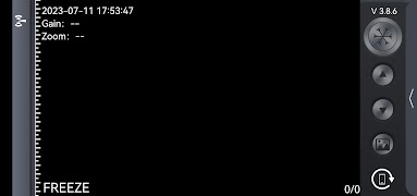 SmartVUS screenshot 3
