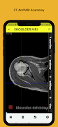 Radiology Anatomy CT And MRI স্ক্রিনশট 7