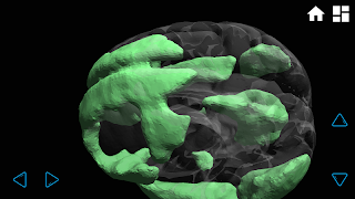 iBraiN स्क्रीनशॉट 4