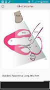 EchoCardioPro imagem de tela 3