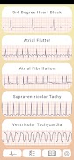 ECG Guide poster