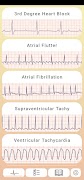 ECG Guide 海报