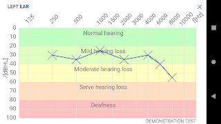 Hearing Test การทดสอบการได้ยิน ภาพหน้าจอ 4