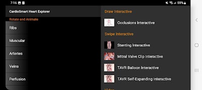 CardioSmart Heart Explorer capture d'écran 4