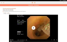 برنامه‌نما eBroncho عکس از صفحه