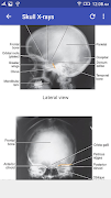 X-Ray Interpretation screenshot 1