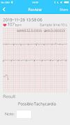 Mini ECG Aide imagem de tela 2