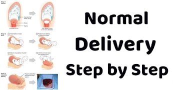 Normal Delivery Tips Poster