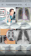 Chest X-Ray Interpretation โปสเตอร์