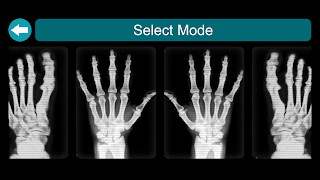 X-Ray Röntgen Tarayıcı Ekran Görüntüsü 1