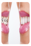 برنامه‌نما Orthodontic Guide عکس از صفحه