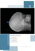 Normal Radiology: CT Brain poster