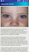 Conjunctivitis & Pinkeye Help plakat