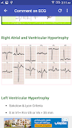 A to Z ECG Interpretation تصوير الشاشة 5