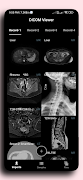 DICOM Viewer ภาพหน้าจอ 5