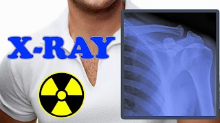 برنامه‌نما X-Ray Filter Photo عکس از صفحه
