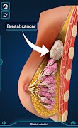 Breast Anatomy Pro. скриншот 4