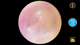 RefitCam Medi syot layar 3