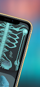 X-Ray Scannerr imagem de tela 5