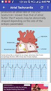 Clinical ECG Guide. screenshot 7