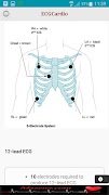ECGCardio screenshot 4