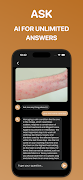 Rash identifier 스크린샷 3