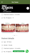 Only Aligners स्क्रीनशॉट 6