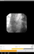 LEADTOOLS DICOM Viewer App 스크린샷 2