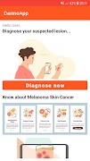 4 Schermata DermoApp: Skincancer detection