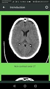 برنامه‌نما Brain CT Scan Interpretation عکس از صفحه
