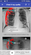 Chest X-Ray Interpretation syot layar 4