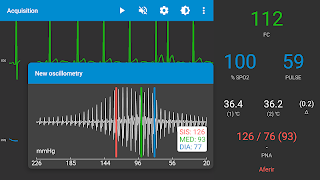 Monitor INpulse স্ক্রিনশট 1