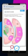 STROKE-ER Rapid Evaluation Too screenshot 2