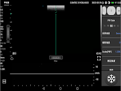 CMS1600 Screenshot 2